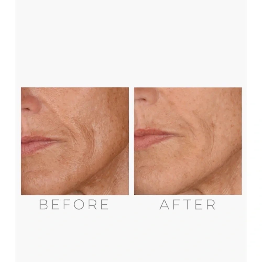 GloPro Skincare Tool -‎ White and Pink